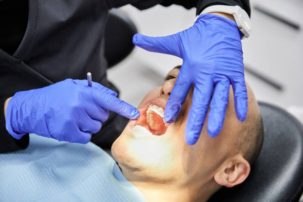 Best Broken or Cracked Tooth Emergency Dentist in Cedar Grove, FL